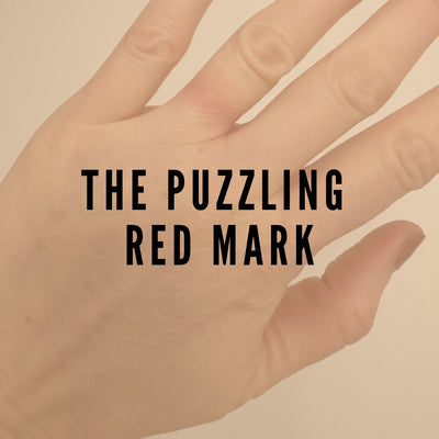 Why Your Favorite Ring Might Be Giving You The Itch! (And How To Avoid It)